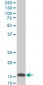 UBE2D2 Antibody (monoclonal) (M02)