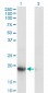 UBE2G1 Antibody (monoclonal) (M01)