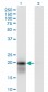 UBE2H Antibody (monoclonal) (M01)