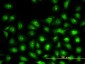 UBE2L3 Antibody (monoclonal) (M01)