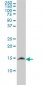 UBE2N Antibody (monoclonal) (M02)