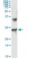 UBE2T Antibody (monoclonal) (M01)