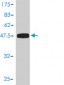 UBE2T Antibody (monoclonal) (M01)