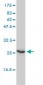 UBE2T Antibody (monoclonal) (M01)