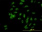 UBE3A Antibody (monoclonal) (M01)