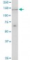 UBE4A Antibody (monoclonal) (M08)