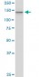 UBE4A Antibody (monoclonal) (M08)