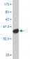 UBR1 Antibody (monoclonal) (M01)