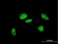 UBR2 Antibody (monoclonal) (M01)