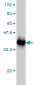 UBTF Antibody (monoclonal) (M01)