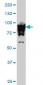 UBTF Antibody (monoclonal) (M01)