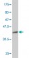 UBTF Antibody (monoclonal) (M02)