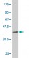 UBTF Antibody (monoclonal) (M02)