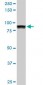 UBTF Antibody (monoclonal) (M02)