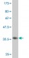 UBTF Antibody (monoclonal) (M03)