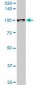 UBTF Antibody (monoclonal) (M03)