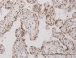 UBTF Antibody (monoclonal) (M04)