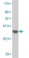 UBTF Antibody (monoclonal) (M04)