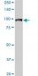 UBTF Antibody (monoclonal) (M04)