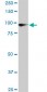 UBTF Antibody (monoclonal) (M04)