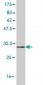UCP1 Antibody (monoclonal) (M01)