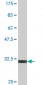 UCP1 Antibody (monoclonal) (M03)