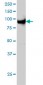 UHRF1 Antibody (monoclonal) (M01)