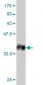 ULK2 Antibody (monoclonal) (M01)