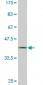 UNC13D Antibody (monoclonal) (M05)