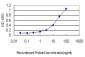 UNC5B Antibody (monoclonal) (M01)