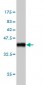 UNC5B Antibody (monoclonal) (M01)