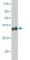UPK1B Antibody (monoclonal) (M02)
