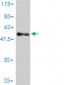 USP15 Antibody (monoclonal) (M01)