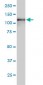 USP15 Antibody (monoclonal) (M01)