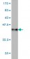 USP4 Antibody (monoclonal) (M01)