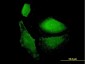 VAMP1 Antibody (monoclonal) (M02)