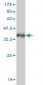 VAMP1 Antibody (monoclonal) (M02)