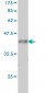 VAV1 Antibody (monoclonal) (M01)