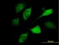 VAV1 Antibody (monoclonal) (M04)