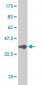 VAV1 Antibody (monoclonal) (M04)