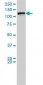 VCL Antibody (monoclonal) (M01)