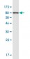 VCP Antibody (monoclonal) (M03)