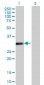 VDAC2 Antibody (monoclonal) (M01)