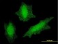 VHL Antibody (monoclonal) (M01)