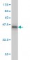 VHL Antibody (monoclonal) (M01)