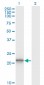 VHL Antibody (monoclonal) (M01)