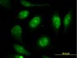 VIM Antibody (monoclonal) (M01)