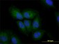 VIM Antibody (monoclonal) (M01)