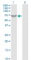 VIM Antibody (monoclonal) (M01)