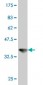 VPS11 Antibody (monoclonal) (M01)